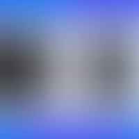Air Purifiers and Allergies: How to Choose the Right Device to Alleviate Your Symptoms